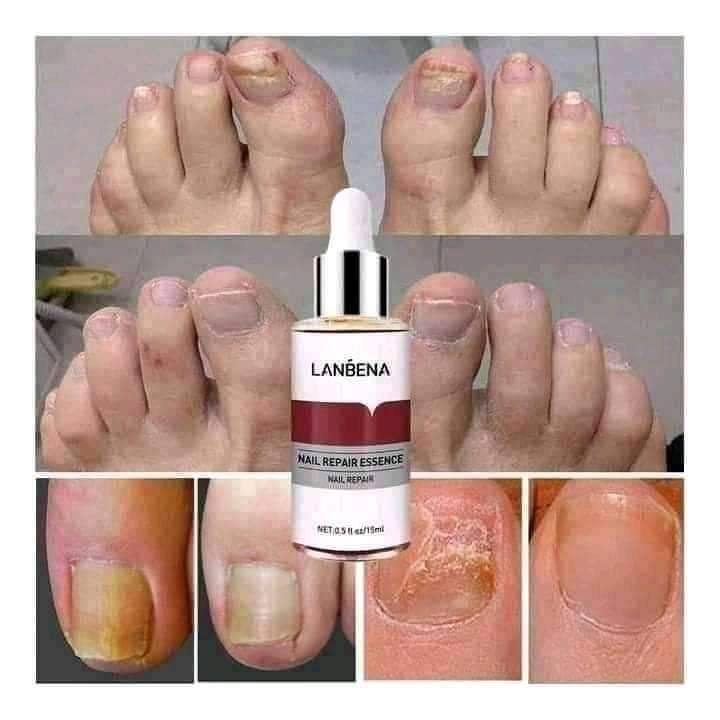 Picture of Lanbena নেইল রিপেয়ার এসেন্স সিরাম