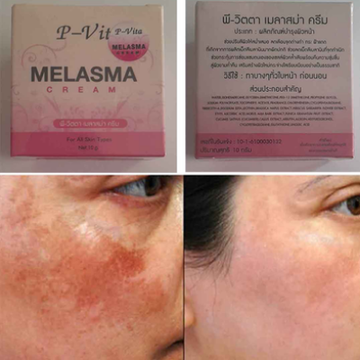 Buy   Bioaqua P Vita Melasma Mesta Whitening Cream - 10 g at Best Price In Bangladesh