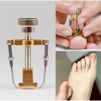  Buy Ingrown Toenail Corrector Pedicure Toenail Fixer Foot Nail Care Orthotic Stainless Steel Treatment Onyxis Bunion Correction Tool  at Best price in Bangladesh