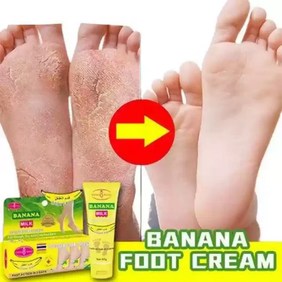 Picture of AICHUN BEAUTY Cracked Heel Cream Foot Care Banana Milk Cream Rough Dry Skin Baby Foot - 80g 