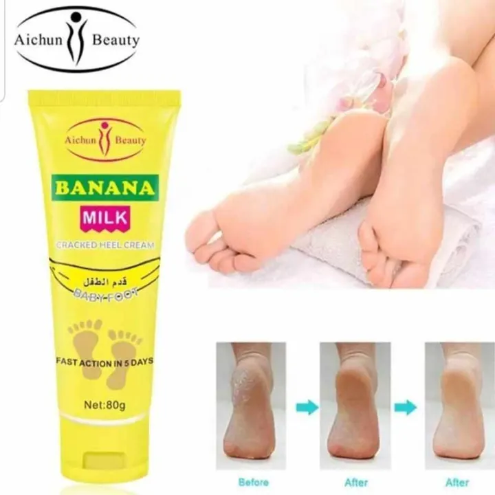 Picture of AICHUN BEAUTY Cracked Heel Cream Foot Care Banana Milk Cream Rough Dry Skin Baby Foot - 80g 