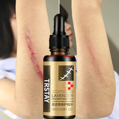 Picture of Lavender Repair Essence Scar Removal Scar Essential Massage Oil For Pregnant Women Hyaluronic Acid Serum Oil Essential Face Ant | 