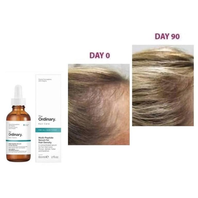 Buy The Ordinary Hair Care Multi-Peptide Serum For Hair Density at Best Price In Bangladesh