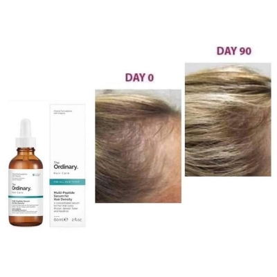 Buy The Ordinary Hair Care Multi-Peptide Serum For Hair Density at Best Price In Bangladesh