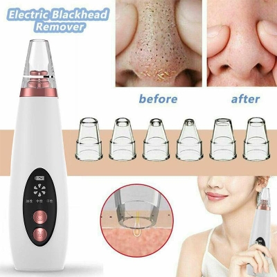 Picture of Blackhead Vacuum: Skin Pore Cleaner