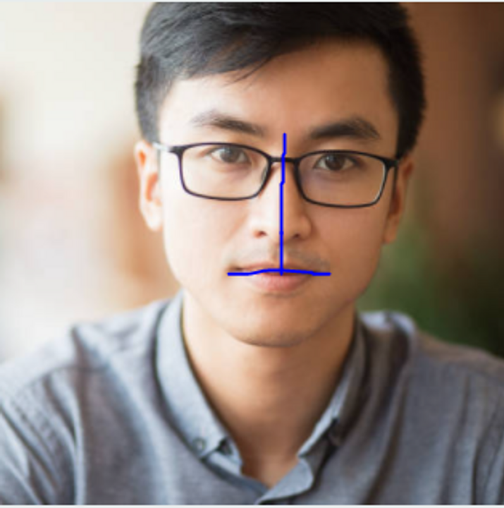 Vùng chữ T ngược, nhìn đây giống như nhìn mắt nha