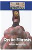 Cystic Fibrosis