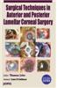 Surgical(R) Tech.In Anterior & Posterior Lamellar Corneal Surgery With Dvd-Rom