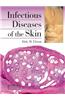 Infectious Diseases of the Skin