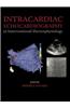 Intracardiac Echocardiography in Interventional Electrophysiology
