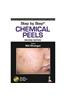 Step by Step: Chemical Peels