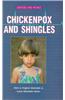 Chickenpox and Shingles
