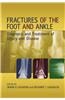 Fractures of the Foot and Ankle: Diagnosis and Treatment of Injury and Disease