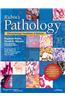 Rubin's Pathology