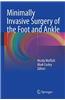 Minimally Invasive Surgery of the Foot and Ankle