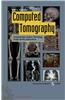 Computed Tomography: Fundamentals, System Technology, Image Quality, Applications [With CDROM]