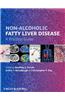 Non-Alcoholic Fatty Liver Disease: A Practical Guide