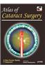 Atlas of Cataract Surgery (with DVD-ROM)