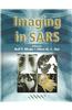 Imaging in SARS