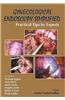 Gynecological Endoscopy Simplified: Practical Tips by Experts