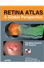 Retina Atlas - A Global Perspective