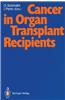 Cancer in Organ Transplant Recipients