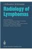 Radiology of Lymphomas