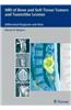 MRI of Bone and Soft Tissue Tumors and Tumorlike Lesions