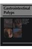 Gastrointestinal Polyps