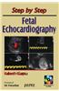 Step by Step Fetal Echocard