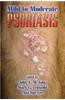 Mild to Moderate Psoriasis