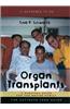 Organ Transplants