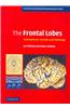 Frontal Lobes