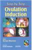 Step By Step Ovulation Induction With Interactive Cd Rom