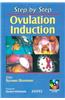 Step by Step Ovulation Induction with CD-ROM