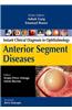 Anterior Segment Diseases