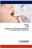 Science of Dental Implants