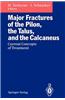 Major Fractures of the Pilon, the Talus, and the Calcaneus