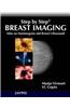 Step by Step Breast Imaging