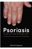 Psoriasis: Diagnosis and Management