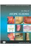 Atlas of Atopic Eczema