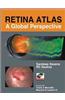 Retina Atlas: A Global Perspective