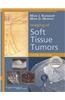 Imaging of Soft Tissue Tumors