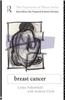 Breast Cancer