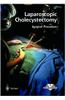 Laparoscopic Cholecystectomy