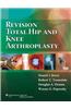 Revision Total Hip and Knee Arthroplasty