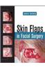 Skin Flaps in Facial Surgery