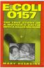 E.coli 0157