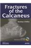 Fractures of the Calcaneus