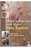 Clinical Synopsis and Color Atlas of Skin Tumors